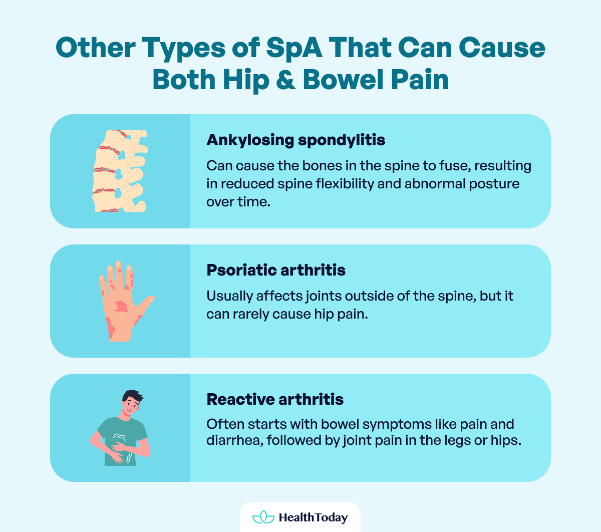 Can Spondyloarthritis Cause Right or Left Hip Pain Related to Bowels 03