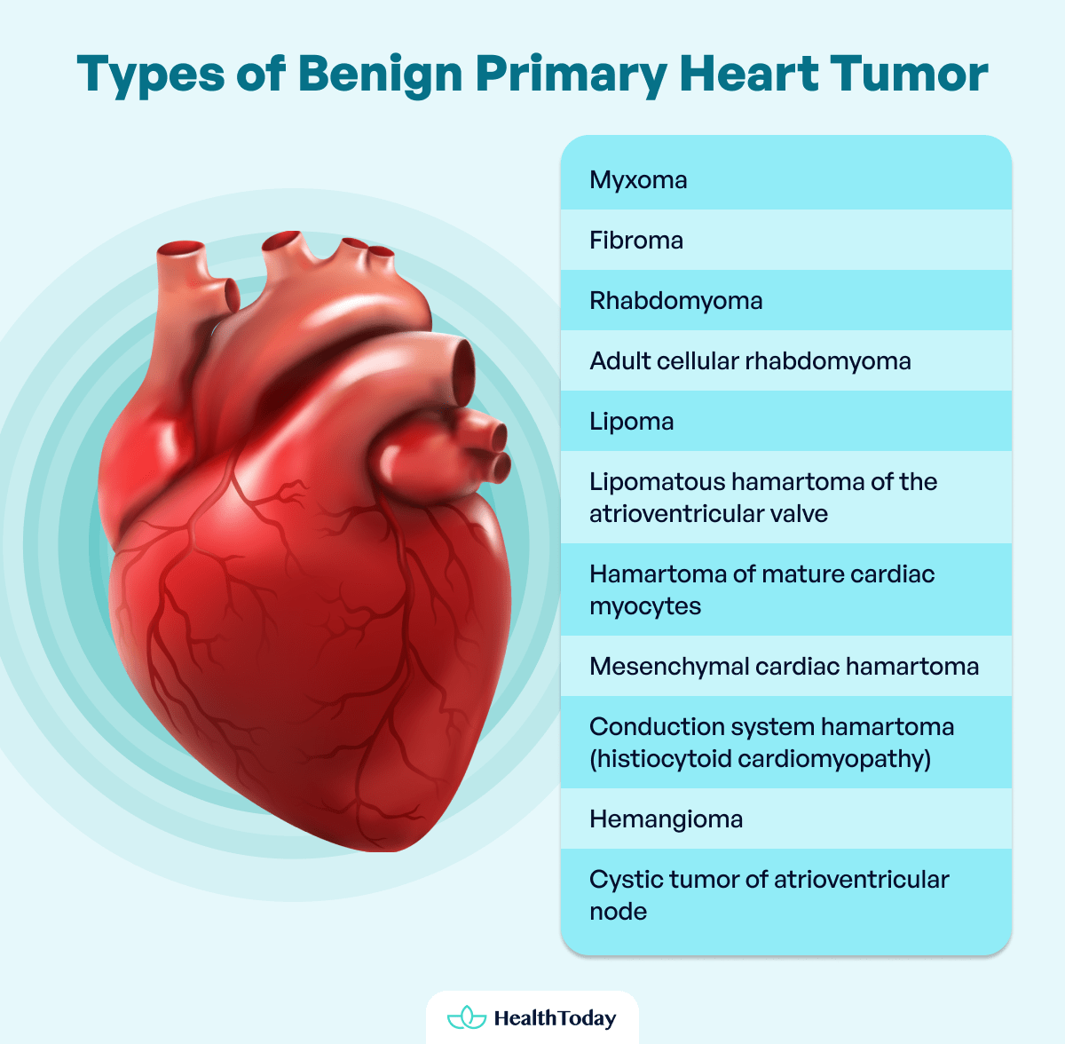 Is There Heart Cancer Types Symptoms Treatments 04