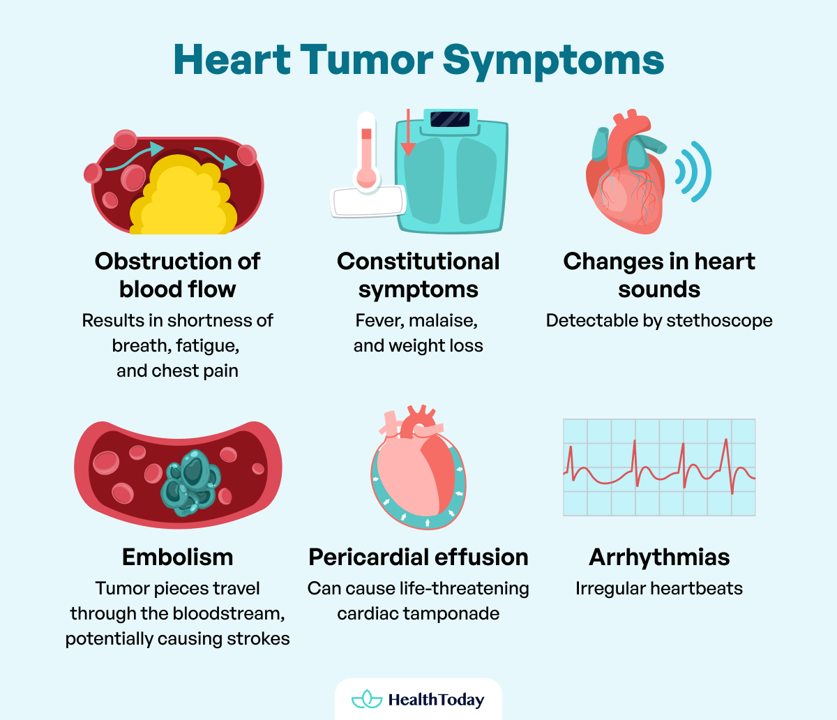 Is There Heart Cancer Types Symptoms Treatments 06