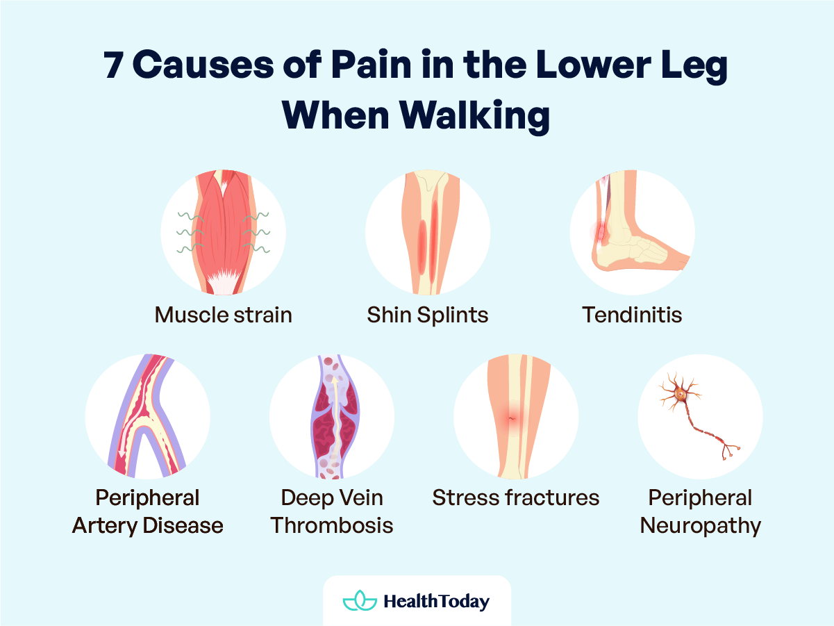 Lower Leg Pain When Walking and Things You Need To Know 01