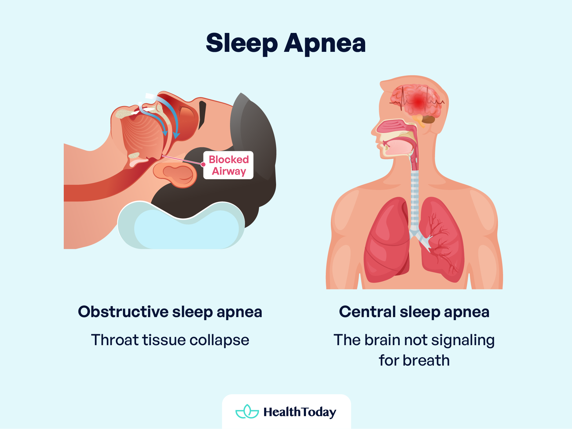 Shallow Breathing While Sleeping Dyspnea vs Apnea 01