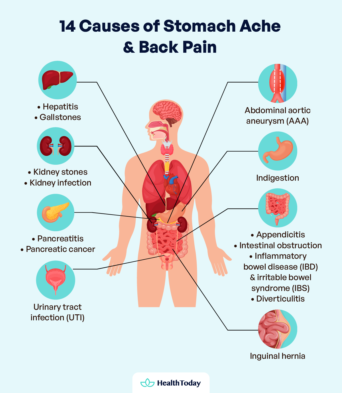 Stomach Pain Radiating to the Back 20 Causes and What to Do 01