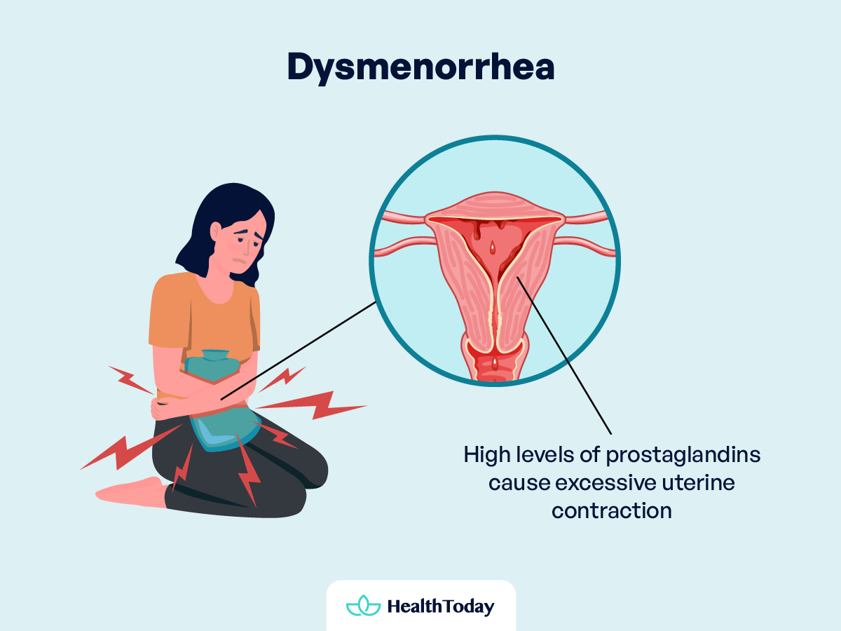 What Causes Period Cramps Normal Severe and More 01