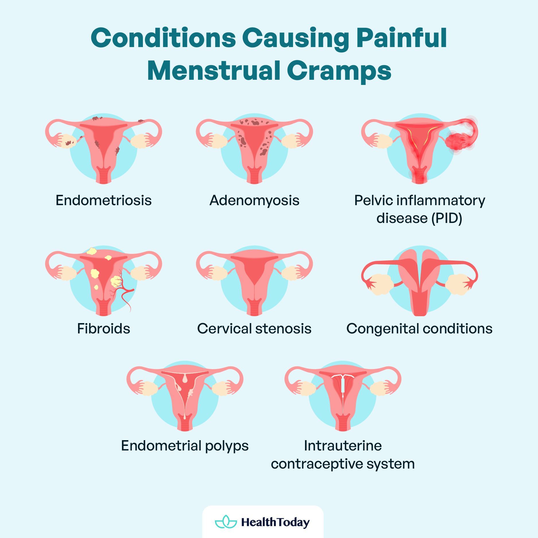What Causes Period Cramps Normal Severe and More 02